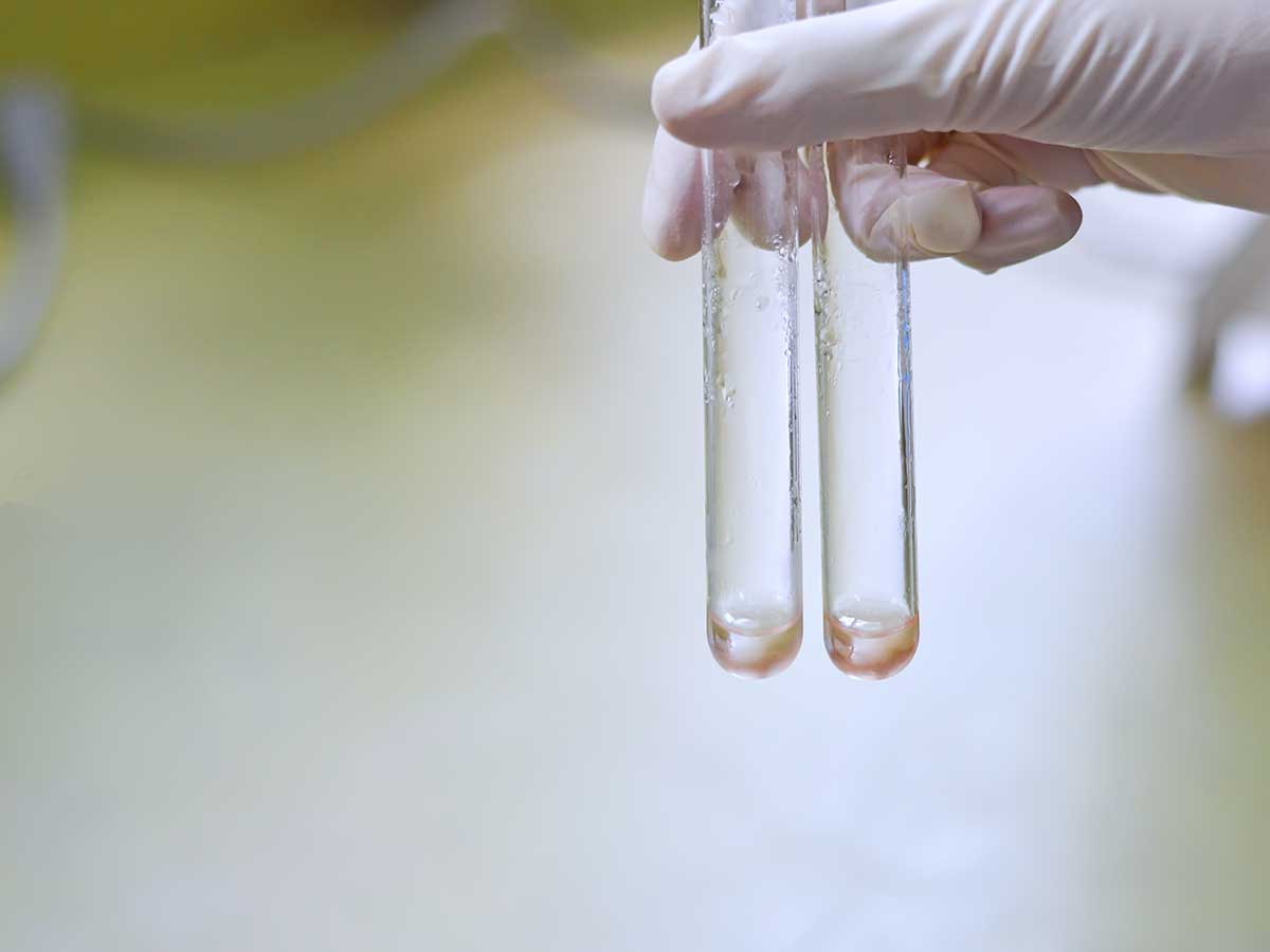 Lavaggio-pipette-matracci